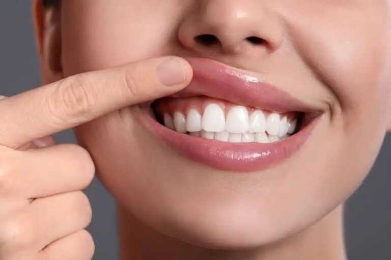 Essential Tips for Keeping Gum Disease at Bay